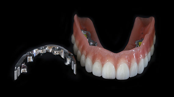 stege-individual-3